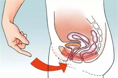提肛运动作用范围